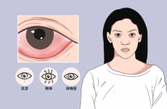 眼睛也会得空调病吗 空调不干净可能导致眼睛患