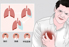 <b>体型单薄的年轻人更容易患上自发性气胸 如何应</b>